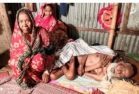 অর্থের অভাবে করতে পারছেন না চিকিৎসা, অসুস্থতায় বিছানায় শুয়ে শরীরে পচঁন ধরেছে শতবছরের বৃদ্ধের