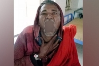 ১০০ টাকা বাজি ধরে গরম চা গিলে হাসপাতালে যুবক!  