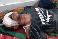 অতিষ্ট হয়ে চিহ্নিত ছিনতাইকারীর পা ভেঙ্গে দু’চোখ নষ্ট করে দিল এলাকাবাসী 