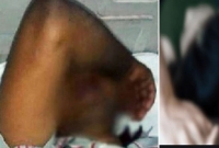 স্বামীর সঙ্গে ভয়ঙ্কর কাণ্ড করে বসলেন স্ত্রী! বিশেষ অঙ্গে সাতটি সেলাই দিতে হলো