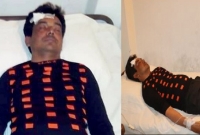  আওয়ামী লীগ নেতা ও উপজেলা চেয়ারম্যান আনোয়ার হোসেনকে চড় মারলেন সবুর আলী!