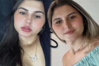 এই দুই যমজ বোনের জীবনে যা ঘটেছে তা বিশ্বে প্রথম