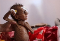 ‘লাখ লাখ ইয়েমেনি শিশু, নারী ও পুরুষের জীবন ধারণের জন্য ত্রাণ সহায়তা প্রয়োজন'