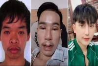 দেখতে খারাপ হওয়ায় চাকরি হয়নি, ৯ বার অস্ত্রপচারে চেহারা পরিবর্তন!