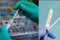  আরেক আতঙ্ক, সন্ধান মিলল নতুন এক প্রাণঘাতী ভাইরাসের, বিশ্বজুড়ে পরবর্তী মহামারির কারণ হতে পারে!