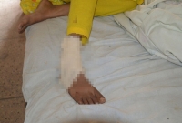 ভালোবেসে বিয়ে, ৫ বছর পর স্ত্রীর পায়ের রগ কাটলেন স্বামী!