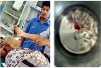 মাথার ভেতরে বাসা, হাঁচি দিলেই বেরিয়ে আসে জীবিত পোকা! মাথার ভেতরে বাসা, হাঁচি দিলেই বেরিয়ে আসে জীবিত পোকা!