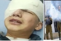  এবার ফিলিস্তিনি ক্ষুদে শিশুর চোখ গুলি করে অন্ধ করে দিয়েছে ইসরাইলি সেনারা