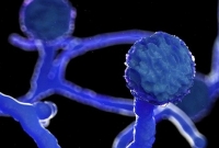 ভারতে করোনা রোগীদের ‘পঙ্গু’ করে দিচ্ছে ব্ল্যাক ফাঙ্গাস!