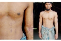 শরীর কেটে বঙ্গবন্ধু-প্রধানমন্ত্রী-আ.লীগের প্রতি ভালোবাসা প্রকাশ