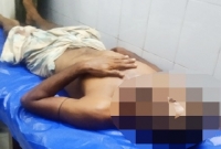 স্ত্রী শুধু সন্দেহ করে, নিজের পুরুষাঙ্গ কাটলেন অভিমানী স্বামী!