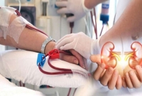 রোগী হাসপাতাল থেকে বাড়ি ফিরলেন ৫টি কিডনি নিয়ে ! কারণ জানলে দারুণ একটি তথ্য জানতে পারবেন!