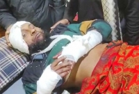 নৌকা মার্কা কর্মীর কবজি কেটেছেন দুর্বৃত্তরা