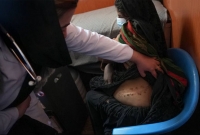 অভাবের তাড়নায় কিডনি বিক্রি করছেন দক্ষিণ এশিয়ার এই দেশটির সাধারণ মানুষ