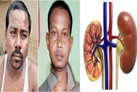 নিজের কিডনি দিয়ে বন্ধুকে বাঁচাতে এগিয়ে এলেন আরেক বন্ধু
