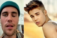 মুখ বেঁকে যাচ্ছে জাস্টিন বিবারের, একপাশ সম্পূর্ণ প্যারালাইজড!