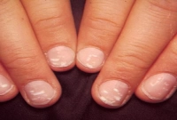 আপনার নখে সাদা দাগ? সত্যিই কি ভয়ের কিছু?