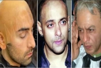 মাথার টাক ঢাকতে কোটি টাকা খরচ করেছেন যে ৯ সুপারস্টার! 