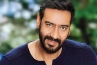 অজয় দেবগন গুরুতর আহত 