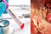 বিশ্বের সবচেয়ে দামি ওষুধ, এক ডোজের দাম ৩৫ কোটি টাকা!