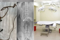 অস্ত্রোপচারের পর কিশোরের পেট থেকে যা বেরোল, অবাক চিকিৎসকেরা!