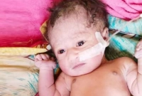 মিরসরাই উপজেলায় চার পা নিয়ে কন্যাশিশুর জন্ম!