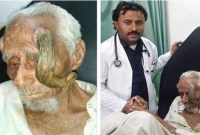 মানুষের মাথায় শিং : কাটার পরই যা ঘটল