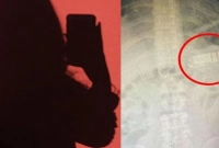 রাগ করে এই তরুণী যা করেছে জানলে অবাক হবেন!