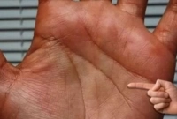 হাতে ‘M’ চিহ্ন থাকলে আপনার সঙ্গে যা ঘটতে পারে!