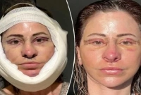 সুন্দরী হতে গিয়ে শেষ পর্যন্ত এই মহিলার ঠাঁই হল রাস্তায়