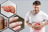 যে খাবার লিভার ভালো রাখে!