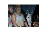 কাপাসিয়ায় রাতের আঁধারে কুপিয়ে শিক্ষকের হাত-পায়ের রগ কর্তন