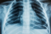 জানেন X-Ray এর আবিষ্কর্তা কে?