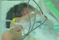 ইসরায়েলি হামলায় মৃত মায়ের পেট থেকে জীবিত শিশু বের করল চিকিৎসকরা