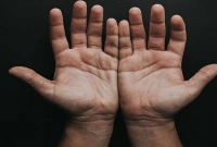 হাতের তালুতে লোম গজায় না কেন? যা বলছে বিজ্ঞানীরা