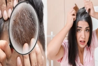 ঝিঙে, সরিষা তেল দিয়ে পাকা চুল কালো হবে গোড়া থেকে!