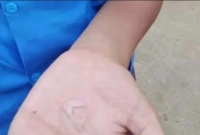 দগ্ধ ২৫ শিক্ষার্থী, হাতে গরম তেল ঢেলে শাস্তি দিল শিক্ষকেরা!