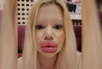 প্রেমিকের আশায় বিশ্বের সবচেয়ে বড় ঠোঁটের তরুণী!