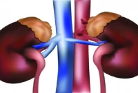 স্ত্রীর কাছ থেকে নিজের কিডনি ফেরত চাইলেন স্বামী!