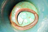 অস্ত্রোপচার-করে-পেট-থেকে-বের-হলো-জীবন্ত-কুঁচিয়া