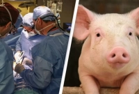 চিকিৎসায় বিশ্বে প্রথম এক ঐতিহাসিক নজির গড়লেন ডাক্তাররা