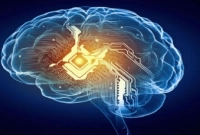 মস্তিষ্ক হ্যাক, সেই হারুনের মাথা থেকে বের করা হলো ক্ষুদ্র ডিভাইস!