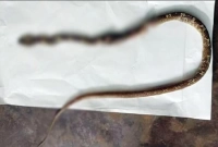  দুই ভাই-বোনকে একসঙ্গে কামড়ালো সাপ