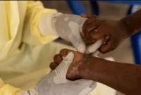 হঠাৎ ভয়াবহ আকারে ছড়িয়ে পড়ছে যে রোগ, জরুরি অবস্থা জারি বিশ্বব্যাপী