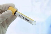 দিন দিন সুন্দরী হচ্ছে মেয়ে, তাই দেখে গোপনে ডিএনএ টেস্ট করলেন বাবা!