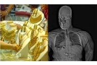 গ্রেফতার এড়াতে ৮ কোটি টাকার গয়না গিলে ফেলল চোর!