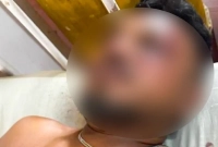 যখন-উঠে-দাঁড়াই-চারপাশে-শুধু-লাশ-বিমানের-বেঁচে-যাওয়া-যাত্রী