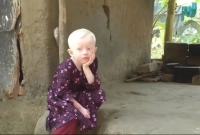 ‘ওর-গায়ের-রং-এইরকম-হলো-বলেই-বাপ-অস্বীকার-করছে-কইছে-এটা-আমার-মেয়ে-না-